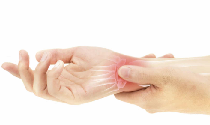 Carpaltunnelsyndrom – hvad siger de nyeste kliniske retningslinjer, og hvordan kan en kiropraktor hjælpe?